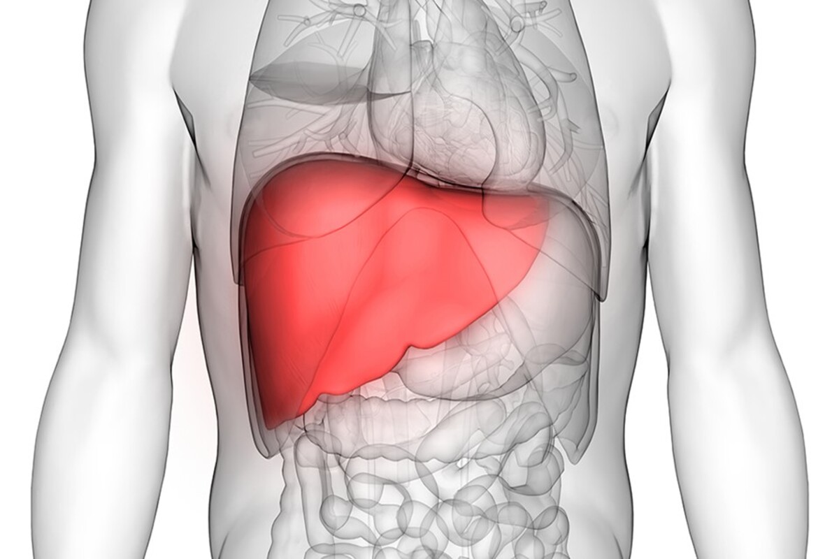 liver cirrhosis