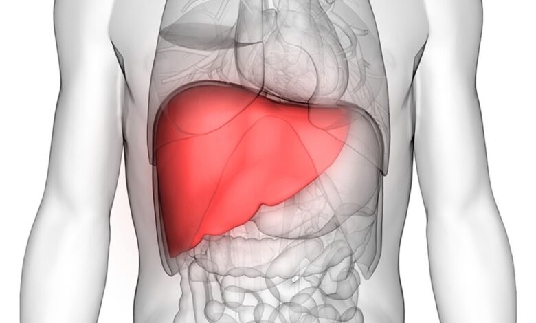 liver cirrhosis